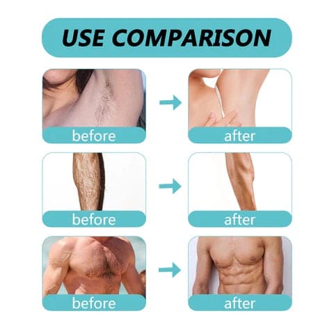 Ecrin Hair Removal Spray Fast Action for Men and Women